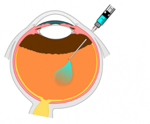 Our Product | Oculogenex